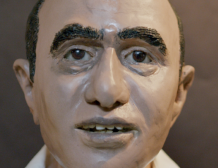 Facial reconstruction